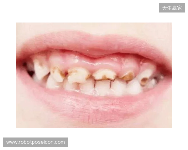 韦林顿确诊上唇部贯通伤；11、21牙半脱位；上颌前牙区牙槽骨骨折